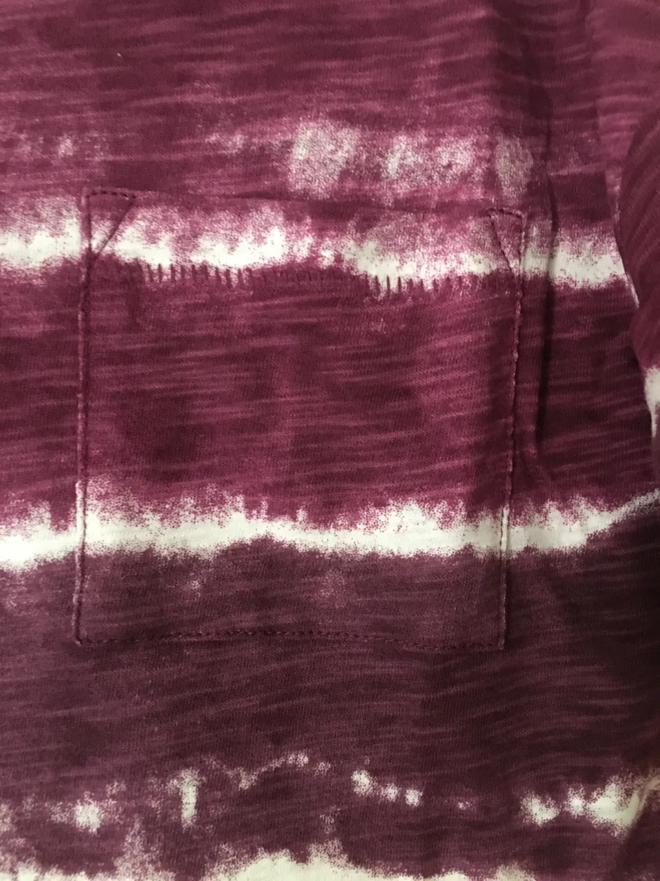 Enterito GAP - Vista 2